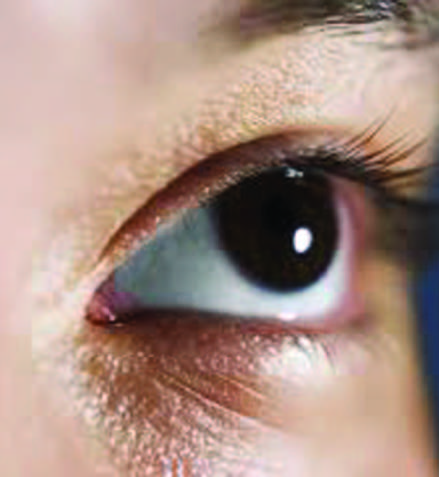 EXERCISES TO REDUCE EYE STRAIN