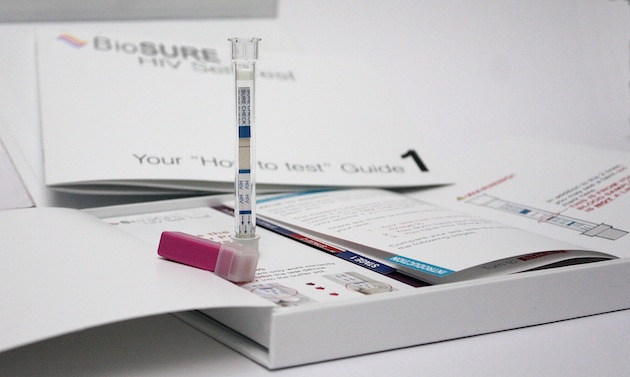 HIV TEST