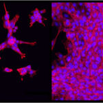 celladhesion-400×204