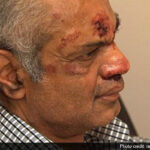 rohit-patel_new_jersey_beatenup_racist_attacks