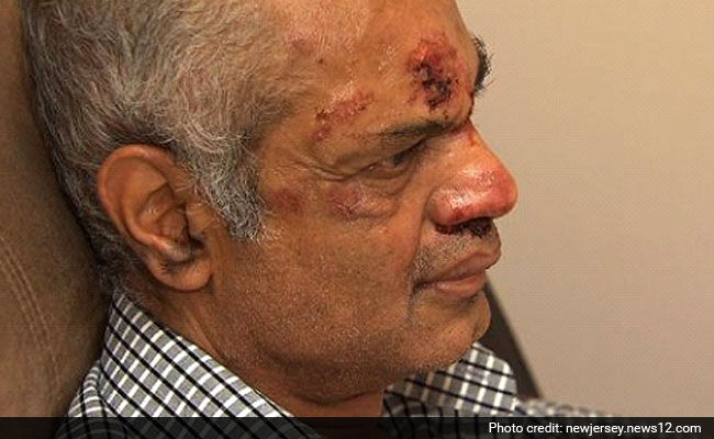 rohit-patel_new_jersey_beatenup_racist_attacks