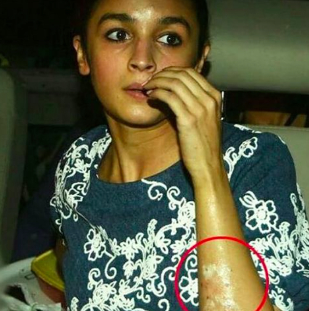 alia bhat