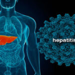 hepatitis_c
