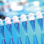 simple blood test may now detect 5 types of cancers