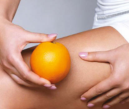 CELLULITE