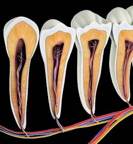 Dental root tip infection