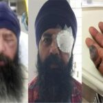 sikh-techie-beaten-hair-cut-with-knife-in-alleged-hate-crime-in-us