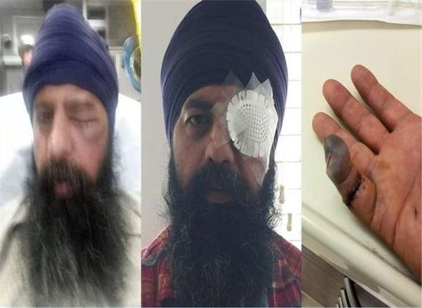 sikh-techie-beaten-hair-cut-with-knife-in-alleged-hate-crime-in-us