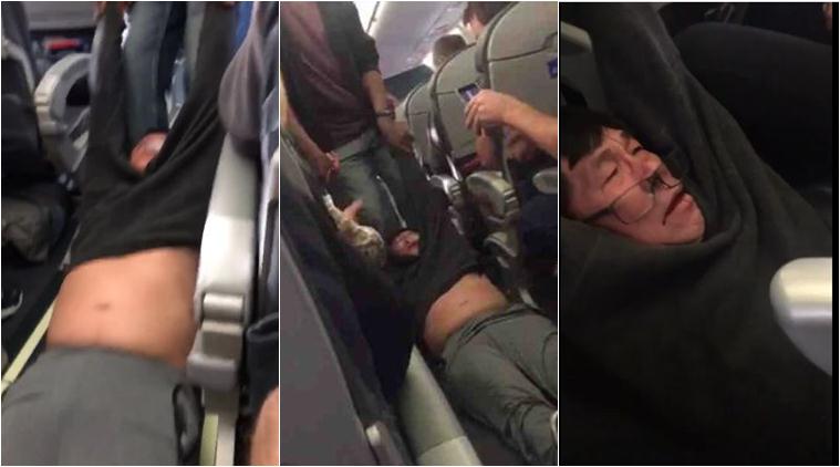 United Airlines Passenger Gets Bloodied, Bruised, Forcibly Removed from Seat