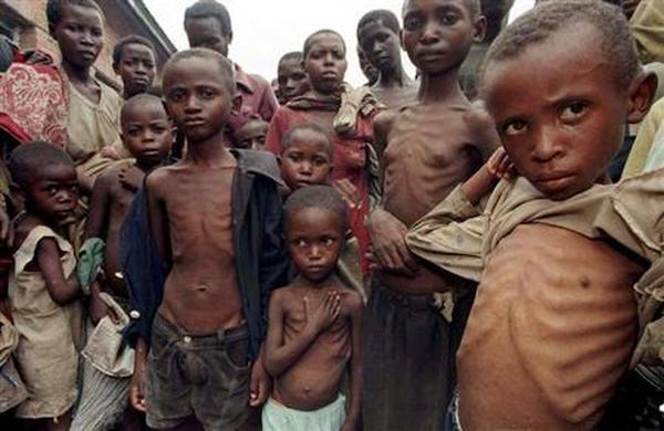 H 1 Malnutritioned children in Rwanda