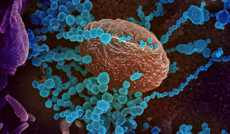 US-HEALTH-VIRUS